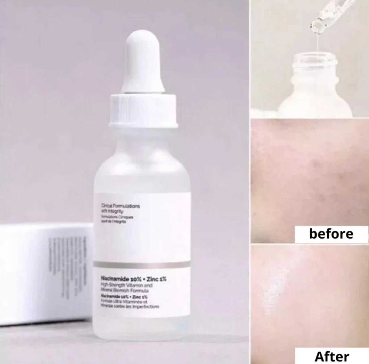 The Ordinary Niacinamide 10% + Zinc 1%