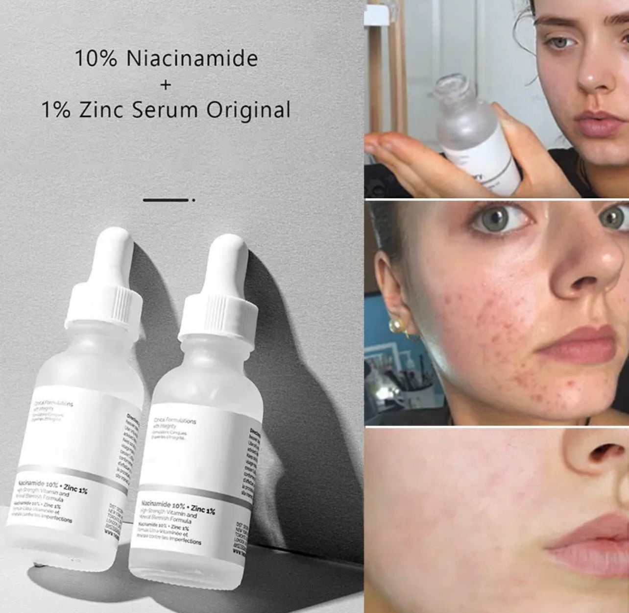 The Ordinary Niacinamide 10% + Zinc 1%