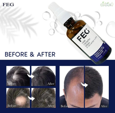 FEG Hair Growth Spray ( Made in USA )