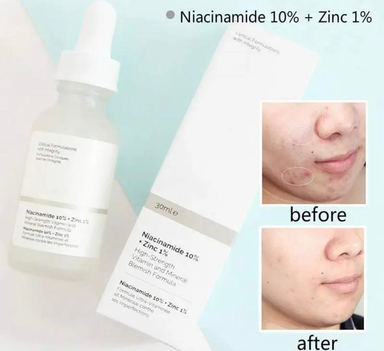 The Ordinary Niacinamide 10% + Zinc 1%